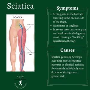 How To Ease Sciatica Pain While Sitting