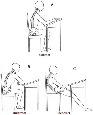 How To Fix Bad Sitting Posture