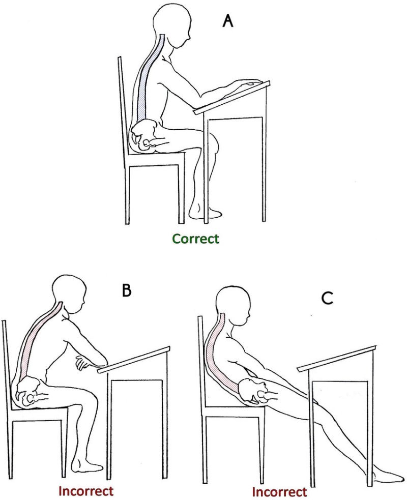 How To Fix Bad Sitting Posture