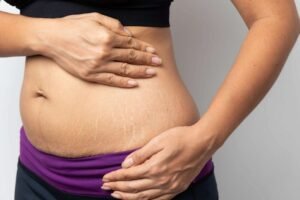 Safe Ways To Lose Weight While Pregnant
