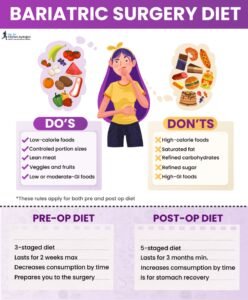 Clear Liquid Diet Before Gastric Sleeve