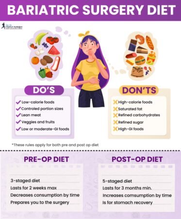 Clear Liquid Diet Before Gastric Sleeve