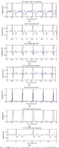 Ecgs Made Easy Aehlert Pdf