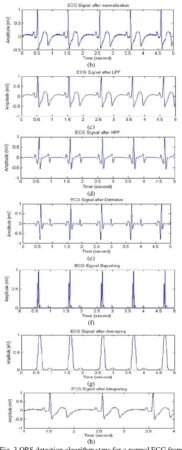 Ecgs Made Easy Aehlert Pdf