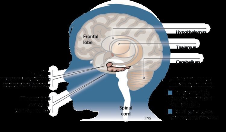 What Causes Autism Spectrum Disorders