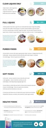 2 Week Liquid Diet Before Gastric Bypass