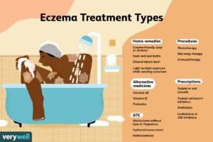 How To Treat Really Bad Eczema