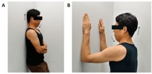 Stretches To Fix Neck Posture