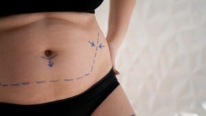 Quick Natural Ways To Lose Belly Fat