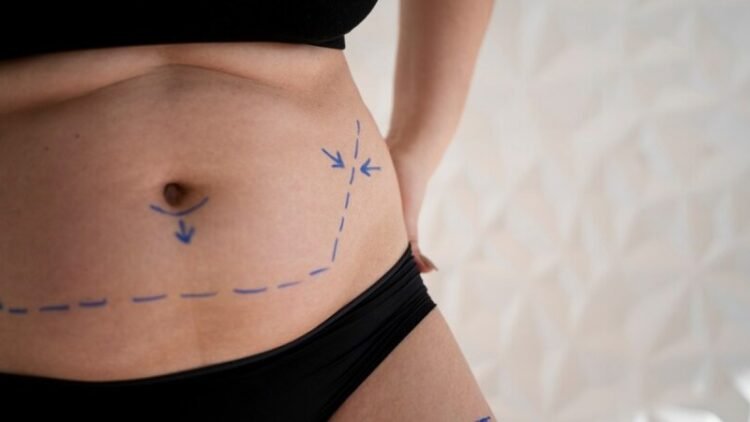 Quick Natural Ways To Lose Belly Fat