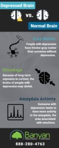How To Tell If Your Depressed