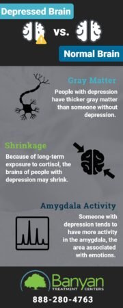 How To Tell If Your Depressed