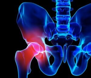 Severe Knee Pain While Sleeping