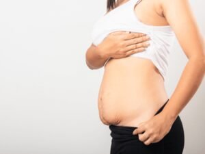Belly Surgery To Lose Weight