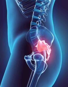 Causes Of Tailbone Pain While Sitting