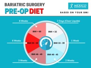 14 Day Liquid Diet For Gastric Sleeve