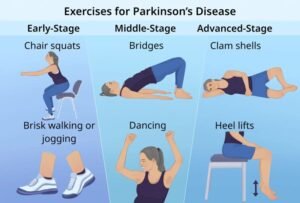 Dance Exercise To Lose Weight Fast At Home