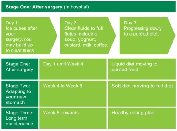Pre Op Diet For Sleeve Surgery